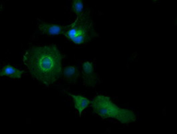 Immunofluorescent analysis of COS7 cells transiently transfected by pCMV6-ENTRY PIK3C2B, labelling PIK3C2B with ab140525 at 1/100 dilution.