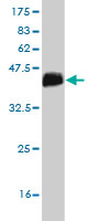 Western blot against tagged recombinant protein immunogen using ab55592 PIK3C2G antibody at 1ug/ml.