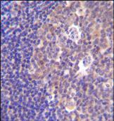 Immunohistochemical analysis of formalin-fixed paraffin-embedded Human tonsil tissue, labeling PIK3R5 using ab170465 at a 1/50 dilution, followed by peroxidase conjugation of the secondary antibody and DAB staining.