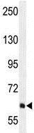 Anti-PIK3R5 antibody - C-terminal (ab170465) at 1/100 dilution + WiDr cell lysate at 35 µg