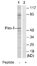 All lanes : Anti-PIM1 antibody (ab74118) at 1/500 dilutionLane 1 : Extracts from Jurkat cellsLane 2 : Extracts from Jurkat cells, plus peptide at 10 µgLysates/proteins at 5 µg per lane.