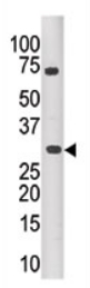 Anti-PIM3 antibody - Carboxyterminal end (ab71321) at 1/100 dilution + mouse kidney tissue lysate at 12.5 µg