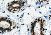 Immunohistochemical analysis of paraffin embedded Human breast tissue, labeling PIN4 with ab155283 at a 1/250 dilution.