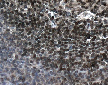 Immunohistochemical analysis of paraffin-embedded Human tonsil tissue, labeling PIN4 with ab155283 at 1/250 dilution.
