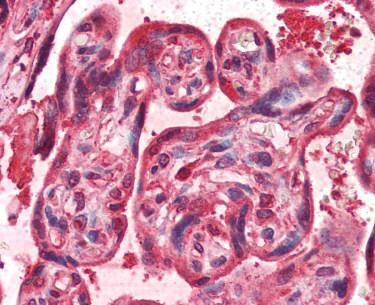 Immunohistochemical analysis of formalin-fixed, paraffin-embedded Human placenta tissue, staining PINK1 with ab117091 at 1/50. Antigen retrieval was performed by heat mediation in citrate buffer (pH 6).