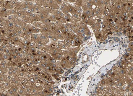 Image courtesy of Human Protein Atlas ab16054 stainning Noggin in paraffin-embedded human liver tissue, showing a cytoplasmic and/or membranous distribution in both hepatocytes and bile duct cells. Paraffin embedded tissue was incubated with ab16054 (1/175 dilution) for 30 minutes at room temperature. Antigen retrieval was performed by heat induction in citrate buffer pH 6.ab16054 was tested in a tissue microarray (TMA) containing a wide range of normal and cancer tissues as well as a cell microarray consisting of a range of commonly used, well characterised human cell lines. Further results for this antibody can be found at www.proteinatlas.org