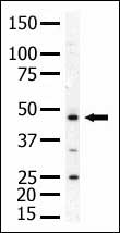 Anti-PIP5K2 alpha antibody (ab37799) at 1/100 dilution + mouse skeletal muscle tissue lysate