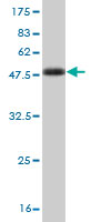 Western blot against tagged recombinant protein immunogen using ab56497 Noggin antibody at 1ug/ml.