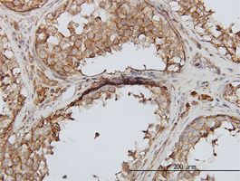 PIP5K3 antibody (ab58126) used in immunohistochemistry at 3ug/ml on formalin fixed and paraffin embedded human testis.