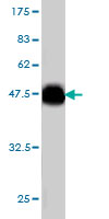 Western blot against tagged recombinant protein immunogen using ab58126 PIP5K3 antibody at 1ug/ml.