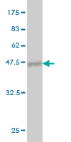 Western blot against tagged recombinant protein immunogen using ab57071 PIP5KI gamma antibody at 1ug/ml.