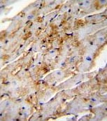 Immunohistochemical analysis of formalin-fixed, paraffin-embedded Human skeletal muscle tissue labeling PIP5KL1 with ab170177 at 1/50 dilution, followed by a peroxidase conjugated secondary antibody and DAB staining.