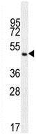 Anti-PIP5KL1 antibody - N-terminal (ab170177) at 1/100 dilution + K562 cell lysate at 35 µg