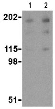 Lane 1 :  Anti-Nogo A antibody (ab62024) at 0.5 µg/mlLane 2 :  Anti-Nogo A antibody (ab62024) at 1 µg/mlLane 1 : Human brain tissue lysateLane 2 : Human brain tissue lysateLysates/proteins at 15 µg per lane.Secondaryanti-rabbit IgG 