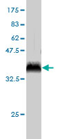 Western blot against tagged recombinant protein immunogen using ab57152 Pirh2 antibody at 1ug/ml.