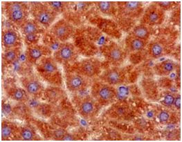 Immunohistochemical analysis of paraffin-embedded mouse liver tissue labeling Pirh2 with ab189247 at 1/50 dilution. The slide is counterstained with Hematoxylin.
