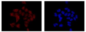 Immunofluorescence analysis of 4% paraformaldehyde-fixed HeLa cells labeling Pirh2 with ab189247 at 1/100 dilution. Goat anti-rabbit IgG (Alexa Fluor® 555) at 1/200 dilution was used as the secondary antibody (red). Slide is counter stained with DAPI (blue).