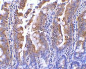 ab37036 at 1µg/ml staining PIST in rat colon tissue by IHC