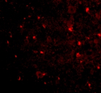 Immunofluorescence of NogoA in Mouse Brain cells using ab62024 at 20 ug/ml.