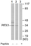 All lanes : Anti-PITX1 antibody (ab72640) at 1/500 dilutionLane 1 : extracts from Jurkat cells Lane 2 : extracts from COLO cellsLane 3 : extracts from Jurkat cells, plus immunising peptide at 5 µgLysates/proteins at 5 µg per lane.