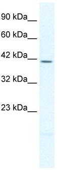 Anti-PITX2 antibody (ab32832) at 2.5 µg/ml + HepG2 cell lysateSecondaryHRP conjugated anti Rabbit IgG at 1/50000 dilution