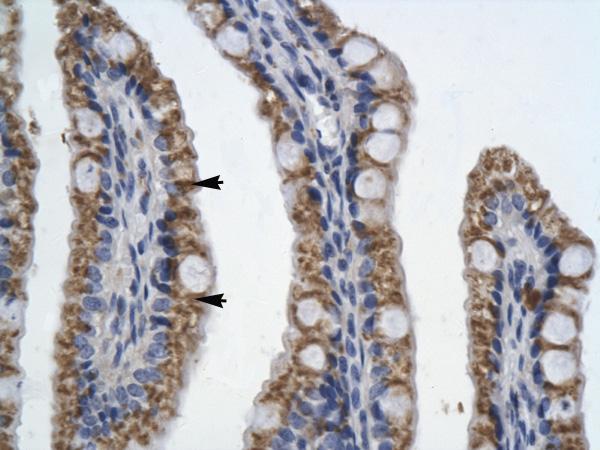 Immunohistochemistry (Formalin/PFA-fixed paraffin-embedded sections) analysis of human intestine tissue labelling PITX2 with ab32832 at 4-8µg/ml. Cells with positive label (as indicated by the arrows) are epithelial cells of the intestinal villus.