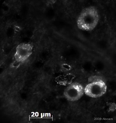 ab30734 staining PITX3 in mouse brain tissue section by Immunohistochemistry (PFA perfusion fixed frozen sections). Tissue from 4% PFA perfused animals underwent overnight fixation in 4% paraformaldehyde, cryoprotected in 30% sucrose and cut using cryostat.The primary antibody was diluted, 1/300 (PBS + 0.3% Triton X100) and incubated with sample for 18 hours at 20°C. An abcam antibody ab60314, Chromeo 488 conjugated goat polyclonal to rabbit IgG, diluted 1/1000 was used as secondary.See Abreview