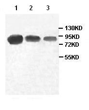 All lanes : Anti-PIWIL4 antibody (ab87939) at 1/500 dilutionLane 1 : HepG2 cell lysateLane 2 : HeLa cell lysateLane 3 : Human fetal testis cell lysate
