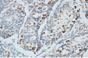 ab87939 at 1/100 dilution, staining PIWIL4 in formalin-fixed paraffin-embedded testis tissue showing nuclear staining.