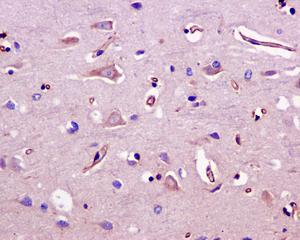 Immunohistochemical analysis of formalin-fixed, paraffin-embedded, Human brain tissue labeling Nogo with ab180847 at a 1/50 dilution.