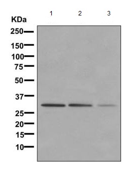 All lanes : Anti-Nogo B receptor antibody [EPR8668] (ab168351) at 1/1000 dilutionLane 1 : A549 cell lysateLane 2 : HUVEC cell lysateLane 3 : HeLa cell lysateLysates/proteins at 10 µg per lane.SecondaryHRP labeled goat anti-rabbit at 1/2000 dilution