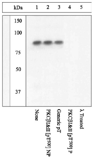 Peptide Competition and Phosphatase Treatment: Lysates prepared from K562 cells stimulated with PMA were resolved by SDS-PAGE on a 10% polyacrylamide gel and transferred to PVDF. Membranes were either left untreated (1-4) or treated with lambda phosphatase (5), blocked with a 5% BSA-TBST buffer for one hour at room temperature, and incubated with ab5817 antibody for two hours at room temperature in a 3% BSA-TBST buffer, following prior incubation with: no peptide (1, 5), the non-phosphopeptide corresponding to the immunogen (2), a generic phosphothreonine-containing peptide (3), or, the phosphopeptide immunogen (4). After washing, membranes were incubated with goat F(ab’ 2 anti-rabbit IgG HRP conjugate and bands were detected using the Pierce SuperSignalTM method. The data show that only the peptide corresponding to PKC beta 1 & 2 [pT500] blocks the antibody signal. The data also show that phosphatase stripping eliminates the signal, verifying that the antibody is phospho-specific.