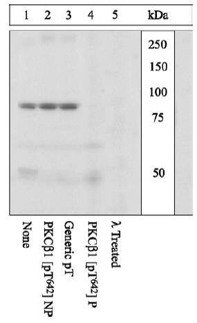 Peptide Competition and Phosphatase Treatment: Lysates prepared from K562 cells stimulated with PMA were resolved by SDS-PAGE on a 10% polyacrylamide gel and transferred to PVDF. Membranes were either left untreated (1-4) or treated with lambda (ë) phosphatase (5), blocked with a 5% BSA-TBST buffer for one hour at room temperature, and incubated with ab5782 antibody for two hours at room temperature in a 3% BSA TBST buffer, following prior incubation with: no peptide (1, 5), the non phosphopeptide corresponding to the immunogen (2), a generic phosphothreonine-containing peptide (3), or, the phosphopeptide immunogen (4). After washing, membranes were incubated with goat F(ab’ 2 anti-rabbit IgG HRP conjugate and bands were detected using the Pierce SuperSignalTM method. The data show that only the peptide corresponding to PKC beta I [pT642] blocks the antibody signal. The data also show that phosphatase stripping eliminates the signal, verifying that the antibody is phospho-specific.