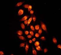 ab32026, at a 1/250 dilution, staining human PKC beta 2 in HeLa cells by Immunoflourescence