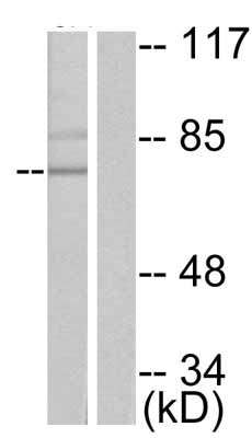 All lanes : Anti-PKC delta (phospho S645) antibody (ab47773) at 1/500 dilutionLane 1 : MCF7 cell extract, untreatedLane 2 : MCF7 cell extract treated with immunogenic phosphopeptide