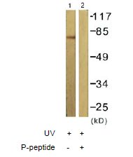 All lanes : Anti-PKC delta (phospho T505) antibody (ab60992) at 1/500 dilutionLane 1 : Extracts from NIH/3T3cells, treated with UV (15mins).Lane 2 : Extracts from NIH/3T3cells, treated with UV (15mins) with immunizing phosphopeptide.