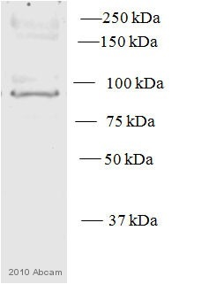 Anti-PKC epsilon antibody (ab63638) at 1/500 dilution + Human Cell Lysate- Whole cell (HMEC) at 20 µgSecondaryDonkey anti rabbit Conjugation: HRP at 1/5000 dilutiondeveloped using the ECL techniquePerformed under reducing conditions.