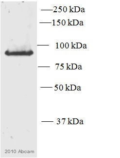 Anti-PKC epsilon antibody (ab63638) at 1/500 dilution + Mouse Cell lysate - whole cell (NIH3T3) at 20 µgSecondaryDonkey anti rabbit HRP linked Conjugation: HRP at 1/5000 dilutiondeveloped using the ECL techniquePerformed under reducing conditions.