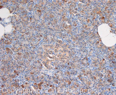 IHC image of PKC epsilon staining in human normal pancreas formalin fixed paraffin embedded tissue section, performed on a Leica BondTM system using the standard protocol F. The section was pre-treated using heat mediated antigen retrieval with sodium citrate buffer (pH6, epitope retrieval solution 1) for 20 mins. The section was then incubated with ab63638, 1µg/ml, for 15 mins at room temperature and detected using an HRP conjugated compact polymer system. DAB was used as the chromogen. The section was then counterstained with haematoxylin and mounted with DPX. For other IHC staining systems (automated and non-automated) customers should optimize variable parameters such as antigen retrieval conditions, primary antibody concentration and antibody incubation times.