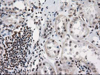 ab114034 at 1/150 dilution staining PKC epsilon in Paraffin-embedded Human Kidney tissue by Immunohistochemistry.