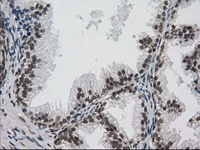 ab114034 at 1/150 dilution staining PKC epsilon in Paraffin-embedded Human Prostate tissue by Immunohistochemistry.