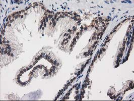 ab114020, at 1/150 dilution, staining PKC epsilon in paraffin-embedded Human prostate tissue by Immunohistochemistry.