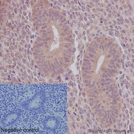 Immunohistochemistry (Formalin/PFA-fixed paraffin-embedded sections) analysis of human endometrium tissue labelling PKC epsilon with unpurified ab124806 at 1/30. Heat mediated antigen retrieval was performed using Tris/EDTA buffer pH 9. A prediluted HRP-polymer conjugated anti-rabbit IgG was used as the secondary antibody. Negative control using PBS instead of primary antibody. Counterstained with Hematoxylin.