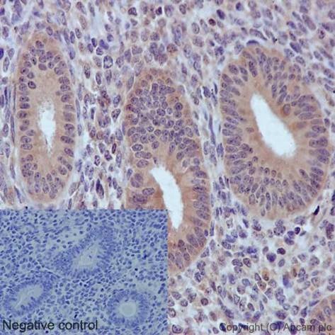 Immunohistochemistry (Formalin/PFA-fixed paraffin-embedded sections) analysis of human endometrium tissue labelling PKC epsilon with purified ab124806 at 1/50. Heat mediated antigen retrieval was performed using Tris/EDTA buffer pH 9. A prediluted HRP-polymer conjugated anti-rabbit IgG was used as the secondary antibody. Negative control using PBS instead of primary antibody. Counterstained with Hematoxylin.