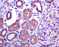 Immunohistochemistry (Formalin/PFA-fixed paraffin-embedded sections) analysis of human kidney tissue labelling PKC epsilon with unpurified ab124806 at 1/100 dilution.