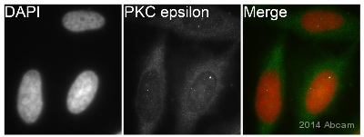 Unpurified ab124806 staining PKC epsilon in human HeLa cells by ICC/IF (Immunocytochemistry/immunofluorescence). Cells were fixed with methanol. Samples were incubated with primary antibody (1/200 in PBS) for 16 hours at 22°C. An Alexa Fluor® 488-conjugated goat anti-rabbit IgG polyclonal (1/200) was used as the secondary antibody. Counterstained with DAPI.See Abreview