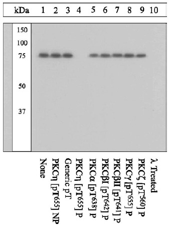 Peptide Competition and Phosphatase Treatment Lysates prepared from Jurkat cells stimulated with PMA were resolved by SDS-PAGE on a 10% polyacrylamide gel and transferred to PVDF. Membranes were either left untreated (1-9) or treated with lambda phosphatase (10), blocked with a 5% BSA-TBST buffer overnight at 4°C, and incubated with 0.50 µg/mL ab5798 antibody for two hours at room temperature in a 3% BSA-TBST buffer, following prior incubation with: no peptide (1, 10), the non phosphopeptide corresponding to the immunogen (2), a generic phosphothreonine containing peptide (3), the phosphopeptide immunogen (4), or, the phosphopeptide corresponding to the immunogen from other PKC isoforms (5-9). After washing, membranes were incubated with goat (ab’)2 anti-rabbit IgG HRP-conjugate and bands were detected using the Pierce SuperSignalTM method. The data show that the peptide corresponding to PKC eta [pT655] blocks the antibody signal. The antibody signal was not blocked by the peptides cor