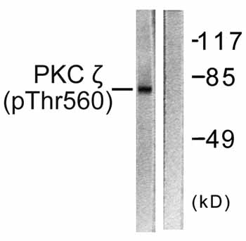All lanes : Anti-PKC zeta (phospho T560) antibody (ab59412) at 1/500 dilutionLane 1 : Extracts from COS7 cells treated with PMA (125ng/ml, 30mins)Lane 2 : Extracts from COS7 cells treated with PMA (125ng/ml, 30mins) with phosphopeptide