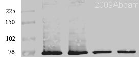 Lane 1 : Lanes 2 - 4 : Anti-PKC zeta antibody (ab59364) at 1/500 dilutionLane 1 : 40 µg Hippocampus lysateLane 2 : 40 µg Hippocampus lysateLane 3 : 20 µg Hippocampus lysateLane 4 : 20 µg Hippocampus lysateSecondaryAnti-Rabbit IR800-linked conjugation: IRDye® 800CWPerformed under reducing conditions.