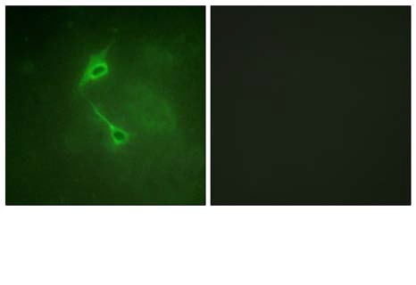 Immunofluorescence analysis of NIH/3T3 cells using PKC zeta at dilution of 1:100.